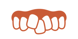 Crowded teeth can be fixed with metal braces treatment - kohe™ Dental