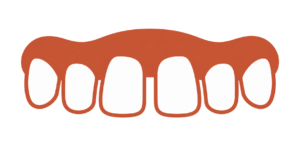 Gaps between teeth can be fixed with metal braces treatment - kohe™ Dental
